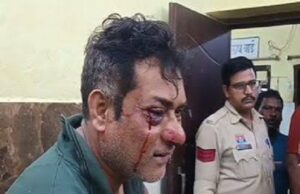 कांग्रेस नेता गुरुप्रीत सिंह सिद्धू पर जानलेवा हमला, BJP नेता पर आरोप; जानें पूरा मामला
