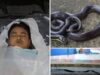 कॉमन करैत का आतंक: सो रहे शख्स को डसा, इलाज से पहले हुई मौत